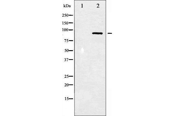 STAT3 antibody  (pTyr705)