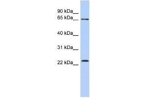 ZNF428 antibody used at 0. (ZNF428 antibody  (N-Term))