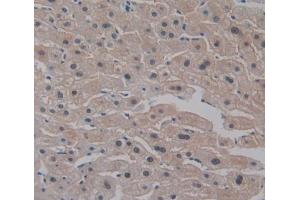 Used in DAB staining on fromalin fixed paraffin- embedded Kidney tissue (CELSR3 antibody  (AA 1181-1421))