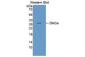 Figure. (PCMT1 antibody  (AA 2-227))