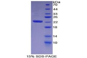 SDS-PAGE analysis of Mouse WARS Protein. (WARS Protein)