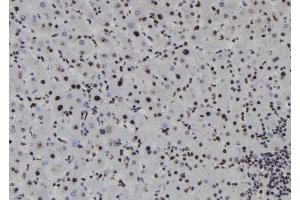 ABIN6278217 at 1/100 staining Human liver tissue by IHC-P. (SOX1 antibody  (Internal Region))