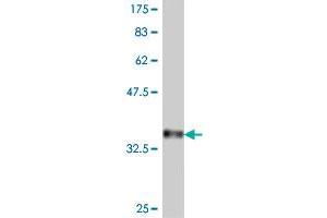 Western Blot detection against Immunogen (37. (Protocadherin 1 antibody  (AA 62-169))