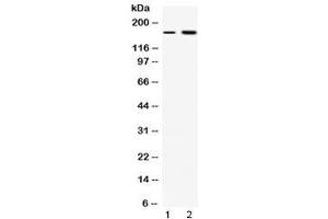 Western blot testing of 1) rat liver and 2) COLO320 lysate with CSB antibody at 0. (ERCC6 antibody  (AA 160-205))