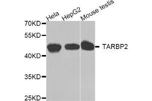 Western blot analysis of extracts of various cell lines, using TARBP2 antibody. (TARBP2 antibody)