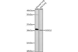 Western blot analysis of extracts of various cell lines, using SOCS2 Rabbit mAb (ABIN7270641) at 1:1000 dilution. (SOCS2 antibody)