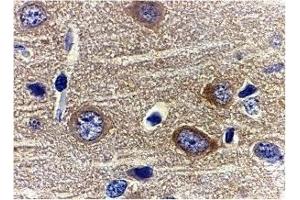 Immunohistochemistry (IHC) image for anti-Adiponectin (ADIPOQ) (N-Term) antibody (ABIN1031215) (ADIPOQ antibody  (N-Term))