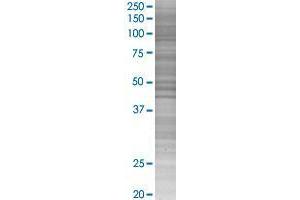 RWDD1 transfected lysate. (RWDD1 293T Cell Transient Overexpression Lysate(Denatured))