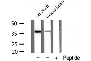 Western blot analysis of extracts of various tissue sample,using PDLIM1 Antibody . (PDLIM1 antibody  (Internal Region))