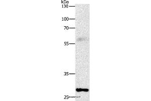 Western blot analysis of Mouse lung tissue, using FGF2 Polyclonal Antibody at dilution of 1:1000 (FGF2 antibody)