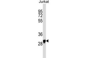 Western Blotting (WB) image for anti-Olfactory Receptor, Family 1, Subfamily N, Member 1 (OR1N1) antibody (ABIN2997556) (OR1N1 antibody)