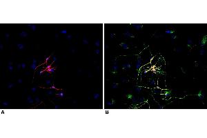 Immunocytochemistry (ICC) image for anti-Tubulin, beta 3 (TUBB3) (N-Term) antibody (ABIN93911)