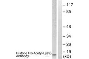 Western Blotting (WB) image for anti-Histone 3 (H3) (H3K9ac) antibody (ABIN2890729) (Histone 3 antibody  (H3K9ac))