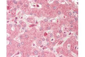 Human Liver: Formalin-Fixed, Paraffin-Embedded (FFPE). (Cathepsin S antibody  (N-Term))