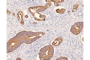 Immunohistochemistry (IHC) image for anti-Keratin 8 (KRT8) (C-Term) antibody (ABIN870549) (KRT8 antibody  (C-Term))