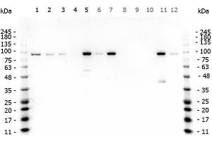 Western Blotting (WB) image for anti-Catenin, beta (CATNB) (C-Term) antibody (ABIN1043906)