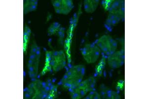 Immunohistochemistry (IHC) image for anti-Solute Carrier Family 12 (Sodium/Chloride Transporters), Member 3 (SLC12A3) (AA 74-95) antibody (ABIN863201)