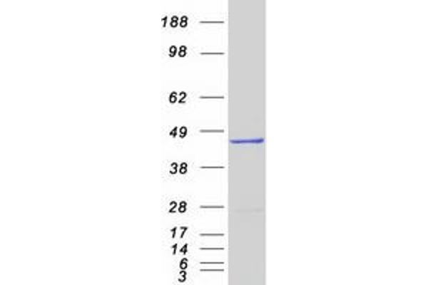 DHODH Protein (Myc-DYKDDDDK Tag)