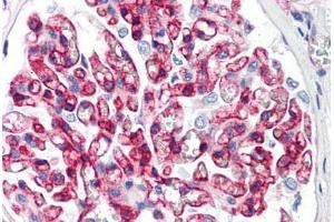 Human Kidney (formalin-fixed, paraffin-embedded) stained with B2M antibody ABIN292915 at 10 ug/ml followed by biotinylated anti-mouse IgG secondary antibody ABIN481714, alkaline phosphatase-streptavidin and chromogen. (beta-2 Microglobulin antibody)