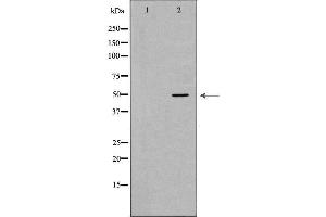 Western blot analysis of extracts of Mouse thymus tissue lysate, using KRT15antibody. (KRT15 antibody  (N-Term))