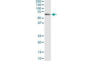 Immunoprecipitation of UGT1A9 transfected lysate using mouse monoclonal anti-UGT1A9 and Protein A Magnetic Bead (UGT1A9 (Human) IP-WB Antibody Pair)