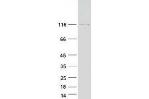 Validation with Western Blot (AASDH Protein (Myc-DYKDDDDK Tag))