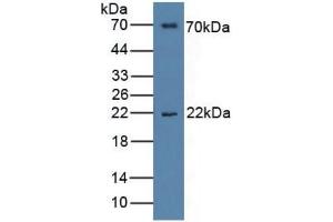 Western Blotting (WB) image for Interleukin 1 Receptor Accessory Protein (IL1RAP) ELISA Kit (ABIN6730975)