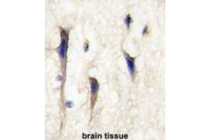 Immunohistochemistry (IHC) image for anti-Cdc42 Guanine Nucleotide Exchange Factor (GEF) 9 (Arhgef9) antibody (ABIN3001570) (Arhgef9 antibody)