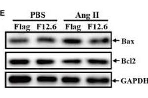 Western Blotting (WB) image for anti-B-Cell CLL/lymphoma 2 (BCL2) (N-Term) antibody (ABIN2857047)