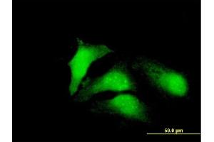 Immunofluorescence of purified MaxPab antibody to CDCA8 on HeLa cell. (CDCA8 antibody  (AA 1-280))