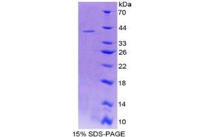 Image no. 1 for serpin Peptidase Inhibitor, Clade B (Ovalbumin), Member 1 (SERPINB1) (AA 17-332) protein (His tag) (ABIN4989812) (SERPINB1 Protein (AA 17-332) (His tag))