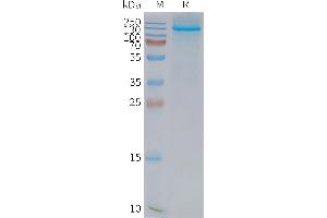 Human L1-Nanodisc, Flag Tag on SDS-PAGE (NPC1L1 Protein)