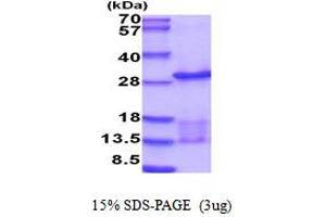 SDS-PAGE (SDS) image for Ubiquitin-Conjugating Enzyme E2E 3 (UBE2E3) (AA 1-207) protein (His tag) (ABIN5854295) (UBE2E3 Protein (AA 1-207) (His tag))