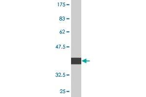 Western Blot detection against Immunogen (37. (TADA2B antibody  (AA 2-110))