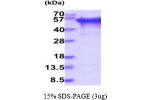 SDS-PAGE (SDS) image for DKK3 (AA 22-350) protein (His tag) (ABIN6387966) (DKK3 Protein (AA 22-350) (His tag))