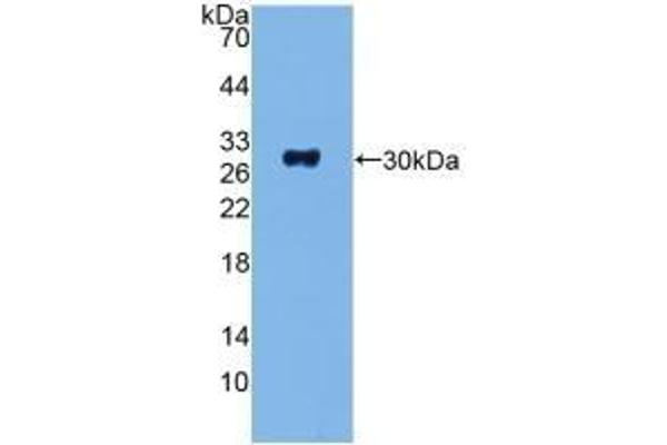 ADCY1 antibody  (AA 835-1061)