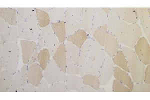 Human skeletal muscle: immunohistochemical staining for Myotilin. (Myotilin antibody  (C-Term))