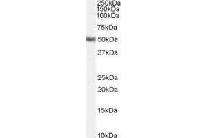 Western Blotting (WB) image for Fatty Acid Desaturase 1 (FADS1) peptide (ABIN369682) (Fatty Acid Desaturase 1 (FADS1) Peptide)