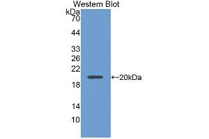 Western blot analysis of the recombinant protein. (SIGLEC5 antibody  (AA 458-551))