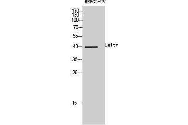 LEFTY1 antibody  (Internal Region)