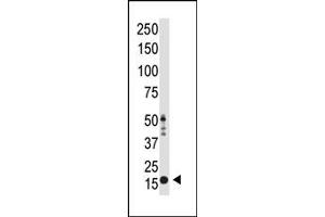 Image no. 1 for anti-Histone 3 (H3) (H3K9me2) antibody (ABIN356586) (Histone 3 antibody  (H3K9me2))