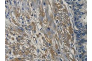 DAB staining on IHC-P; Samples: Human Prostate Tissue (TRAPPC10 antibody  (AA 74-357))