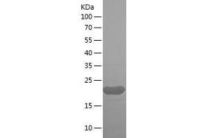 Western Blotting (WB) image for Peptidyl-tRNA Hydrolase ICT1, Mitochondrial (AA 30-206) protein (His tag) (ABIN7124341) (Peptidyl-tRNA Hydrolase ICT1, Mitochondrial (AA 30-206) protein (His tag))