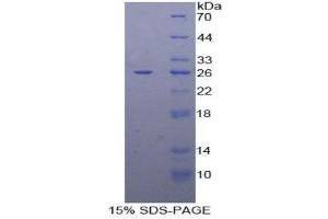 SDS-PAGE (SDS) image for Dihydrolipoamide Dehydrogenase (DLD) (AA 280-487) protein (His tag) (ABIN2124631) (DLD Protein (AA 280-487) (His tag))