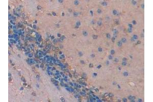 DAB staining on IHC-P; Samples: Mouse Cerebrum Tissue (IDS antibody  (AA 180-448))