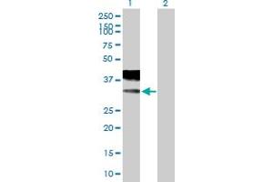 Western Blot analysis of CACNG2 expression in transfected 293T cell line by CACNG2 MaxPab polyclonal antibody. (Stargazin antibody  (AA 1-323))