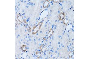 Immunohistochemistry of paraffin-embedded rat kidney using LDLRAP1 antibody. (LDLRAP1 antibody)