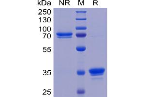 TNFRSF12A Protein (AA 28-80) (mFc Tag)