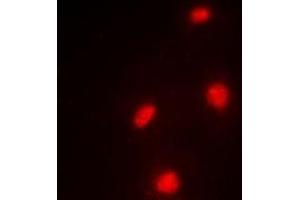 Immunofluorescent analysis of MTF-2 staining in A549 cells. (MTF2 antibody)