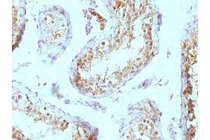 Formalin-fixed, paraffin-embedded human testicular carcinoma stained with anti-Perlecan antibody (SPM255). (HSPG2 antibody)